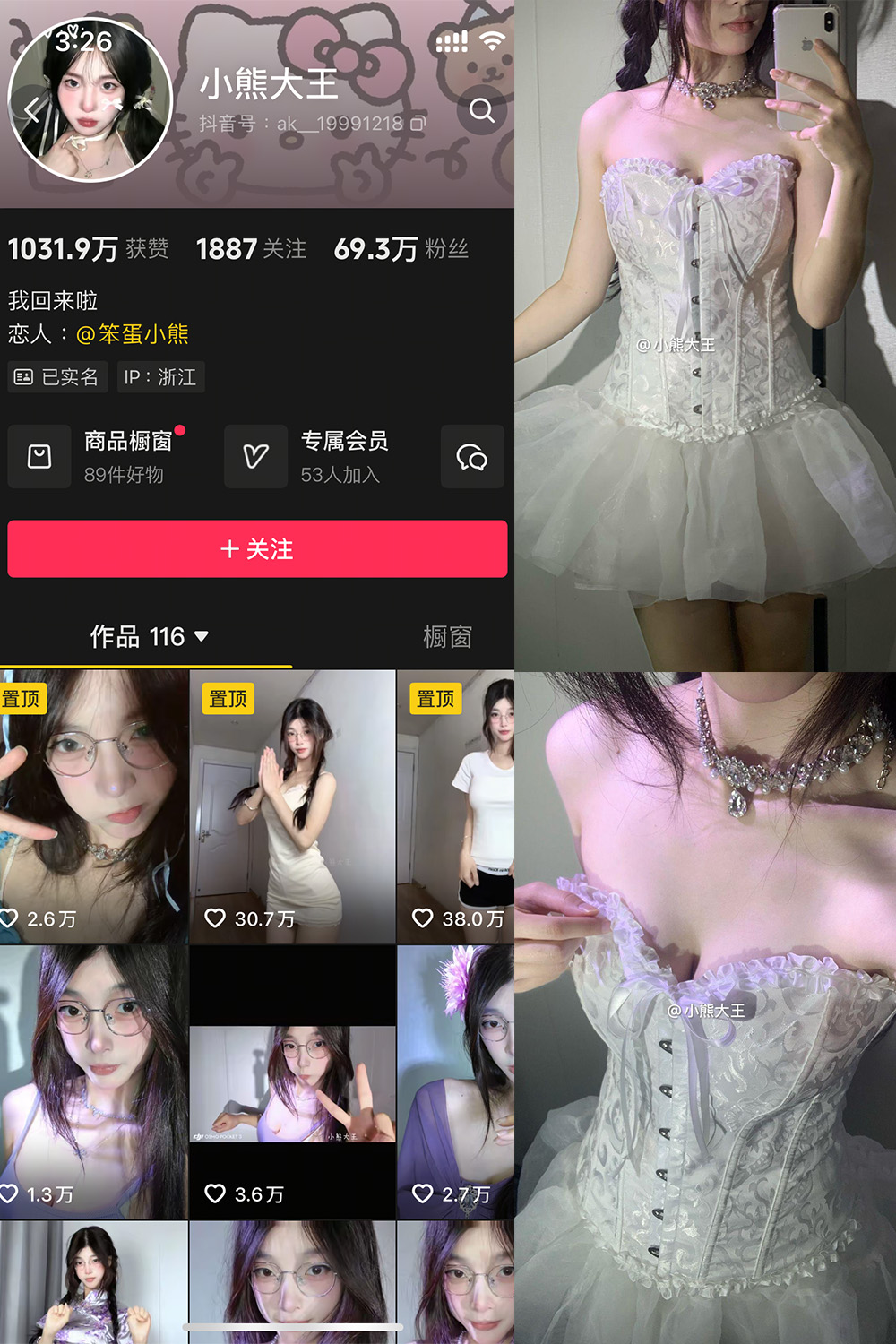 抖音 小熊大王 微密圈 001期 【32P】-暖色.top